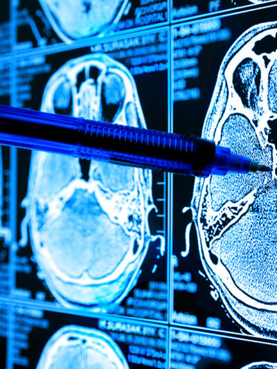 A Doctor points to AI biomedical algorithm screen.