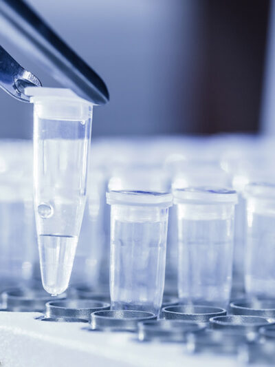 Close-up of tweezers loading test tubes with sampled DNA.